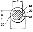 Transverse Hip Section